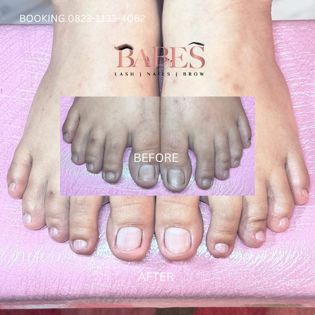 pedicure